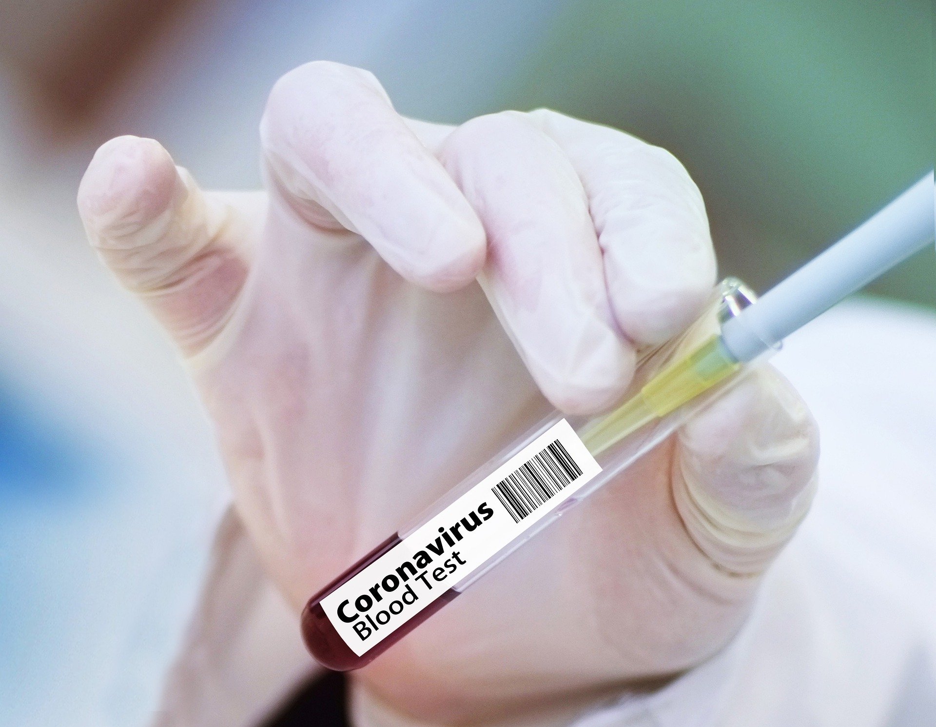 1 es de Machalí: Confirman 15 nuevos casos de coronavirus en O´Higgins